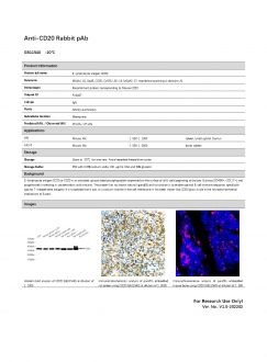 Антитела Anti-CD20 Rabbit pAb, 100 мкл (арт. GB11540)