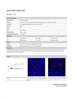 Антитела Anti-FOXP3 Rabbit pAb, 100 мкл (арт. GB112325)